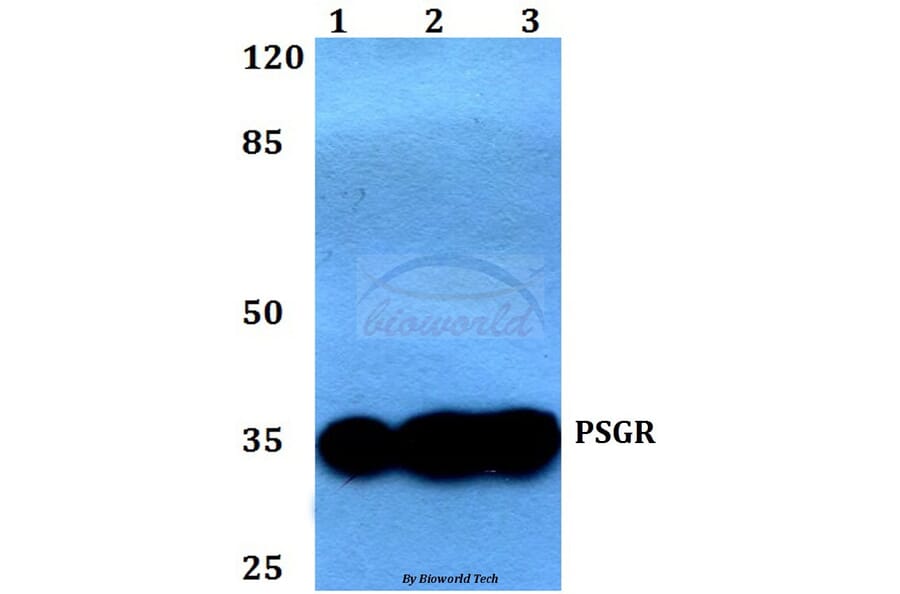Anti-PSGR (F237) Antibody from Bioworld Technology (BS2837) - Antibodies.com