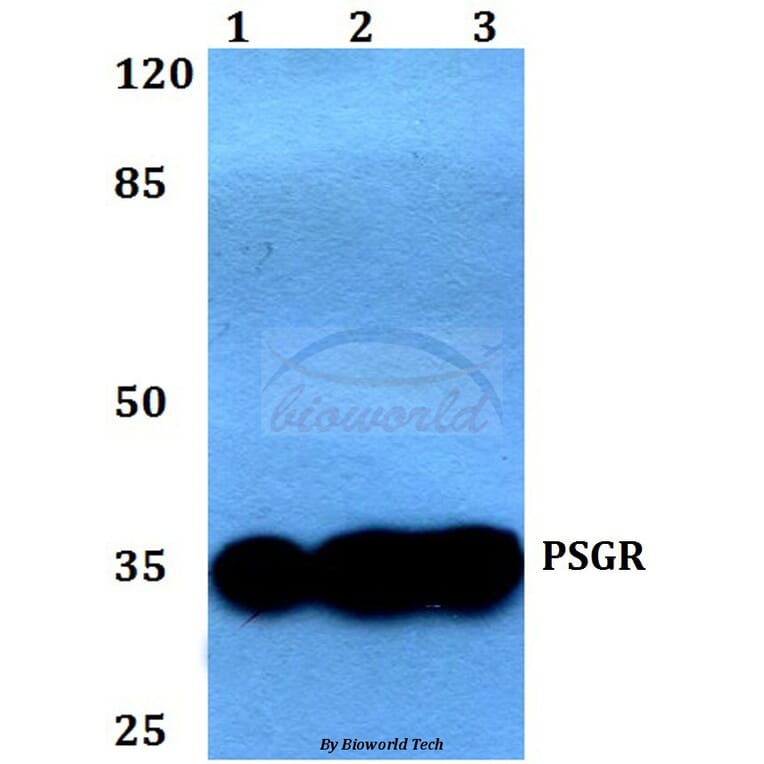 Anti-PSGR (F237) Antibody from Bioworld Technology (BS2837) - Antibodies.com