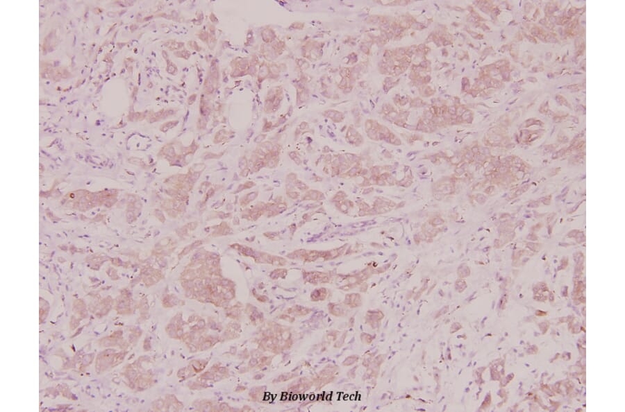 Anti-GROγ (N177) Antibody from Bioworld Technology (BS2838) - Antibodies.com