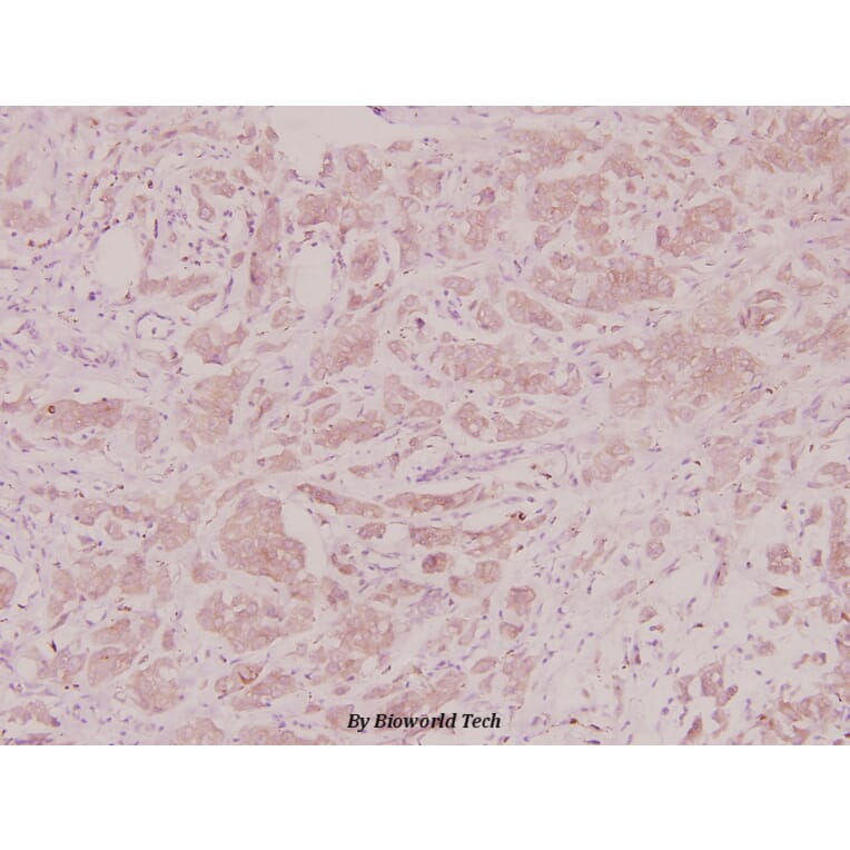 Anti-GROγ (N177) Antibody from Bioworld Technology (BS2838) - Antibodies.com