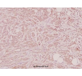 Anti-NTF4 (V120) Antibody from Bioworld Technology (BS2840) - Antibodies.com