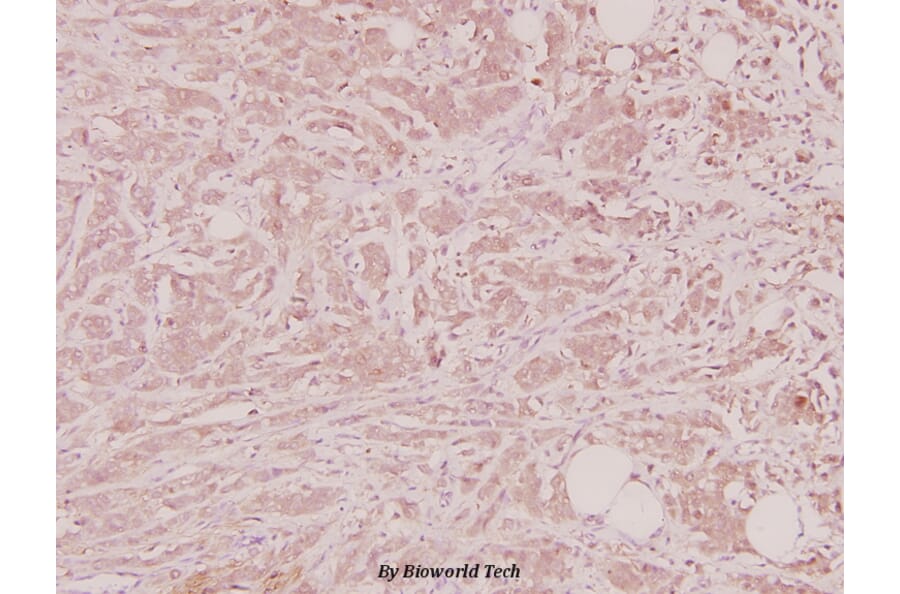 Anti-NTF4 (V120) Antibody from Bioworld Technology (BS2840) - Antibodies.com