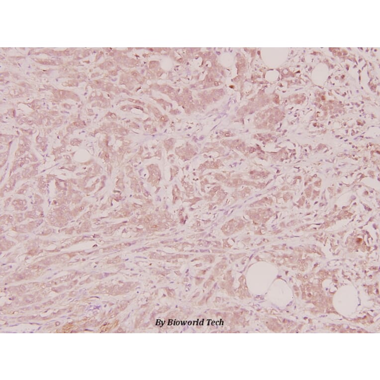 Anti-NTF4 (V120) Antibody from Bioworld Technology (BS2840) - Antibodies.com