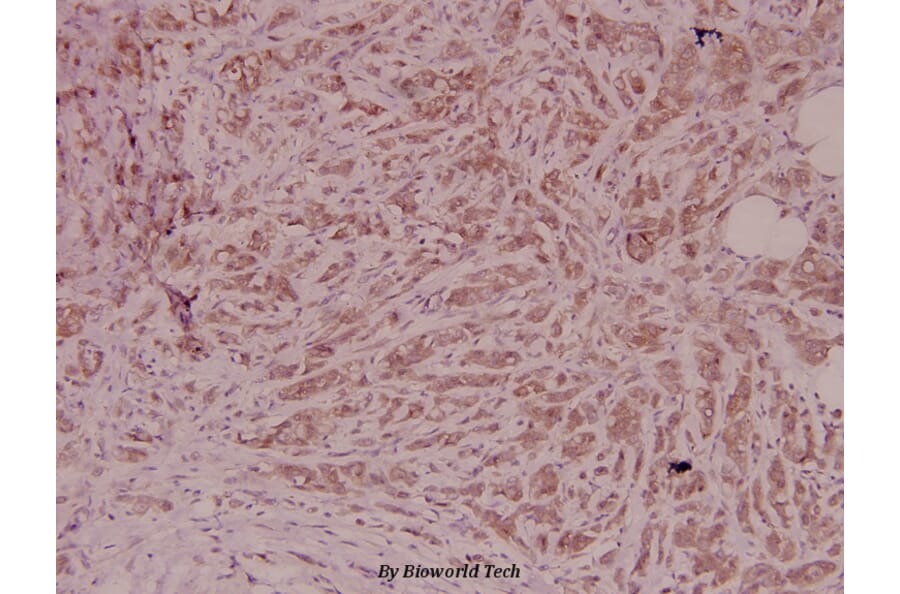 Anti-PEDF (T307) Antibody from Bioworld Technology (BS2842) - Antibodies.com