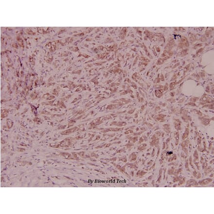 Anti-PEDF (T307) Antibody from Bioworld Technology (BS2842) - Antibodies.com