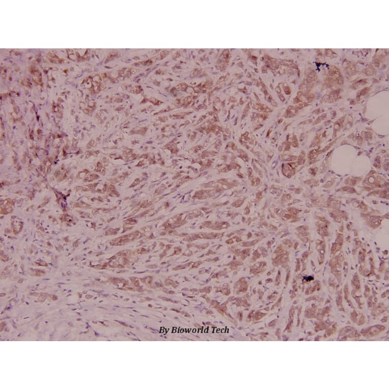 Anti-PEDF (T307) Antibody from Bioworld Technology (BS2842) - Antibodies.com