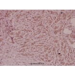 Anti-PEDF (T307) Antibody from Bioworld Technology (BS2842) - Antibodies.com