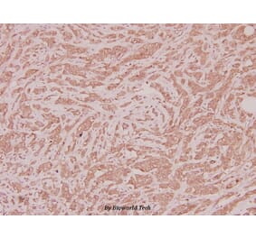 Anti-CLN1 (I65) Antibody from Bioworld Technology (BS2843) - Antibodies.com