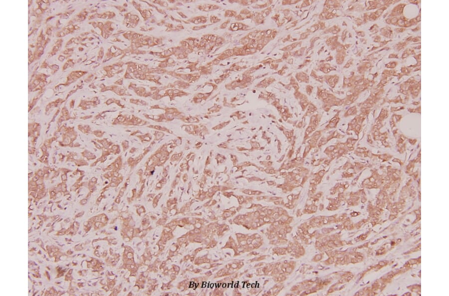 Anti-CLN1 (I65) Antibody from Bioworld Technology (BS2843) - Antibodies.com
