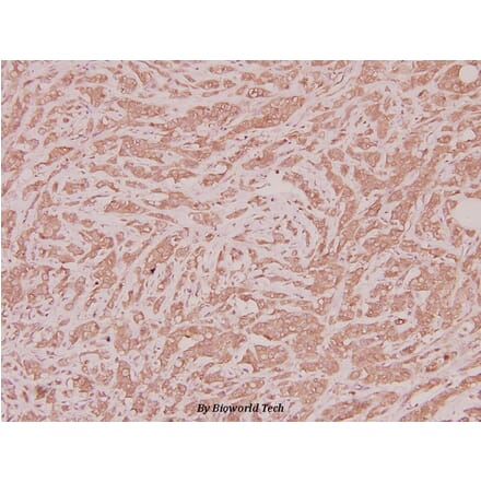 Anti-CLN1 (I65) Antibody from Bioworld Technology (BS2843) - Antibodies.com