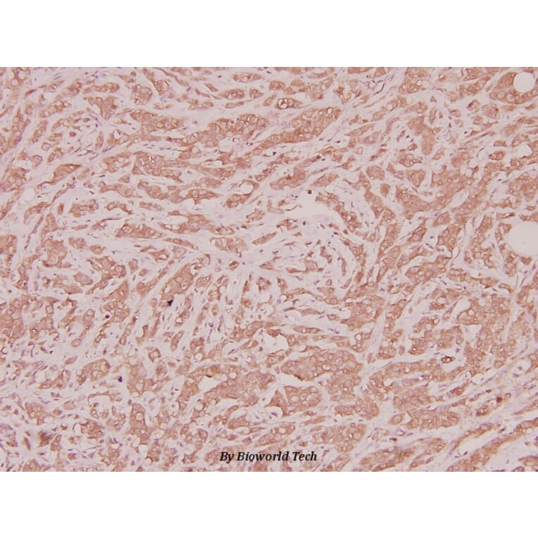 Anti-CLN1 (I65) Antibody from Bioworld Technology (BS2843) - Antibodies.com