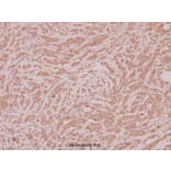 Anti-CLN1 (I65) Antibody from Bioworld Technology (BS2843) - Antibodies.com