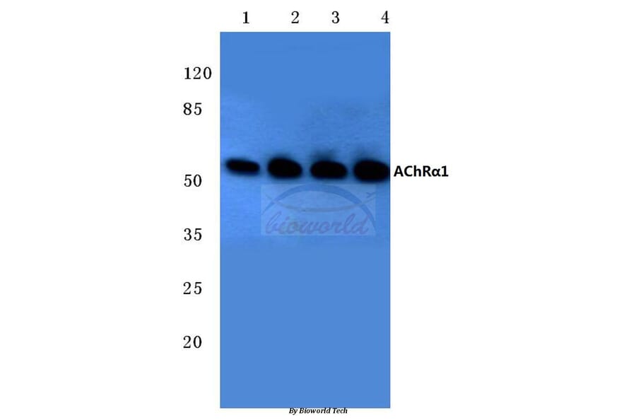Anti-AChRα1 (E217) Antibody from Bioworld Technology (BS2850) - Antibodies.com