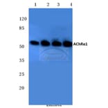 Anti-AChRα1 (E217) Antibody from Bioworld Technology (BS2850) - Antibodies.com
