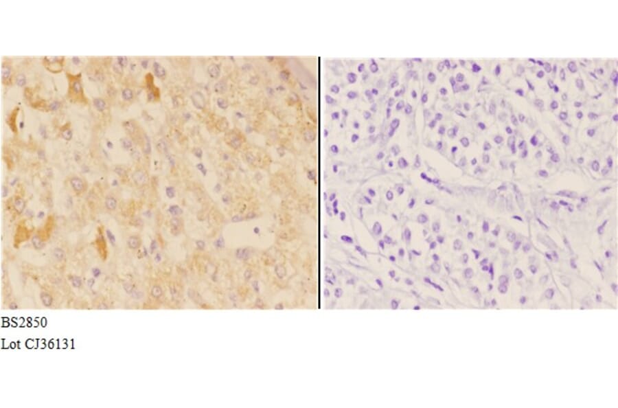 Anti-AChRα1 (E217) Antibody from Bioworld Technology (BS2850) - Antibodies.com