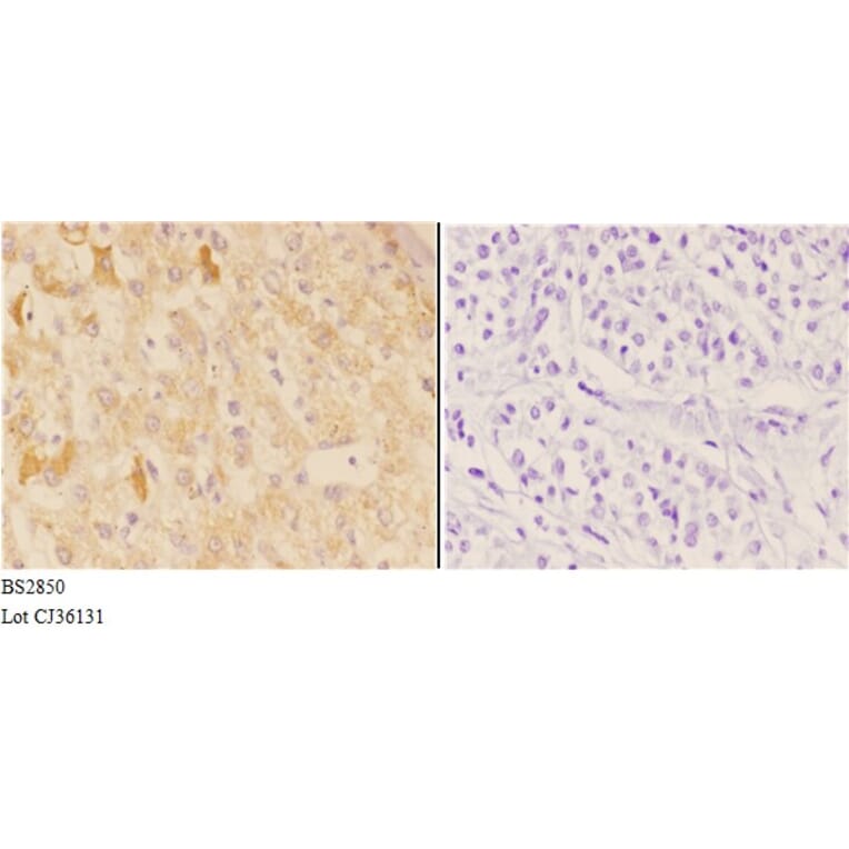 Anti-AChRα1 (E217) Antibody from Bioworld Technology (BS2850) - Antibodies.com