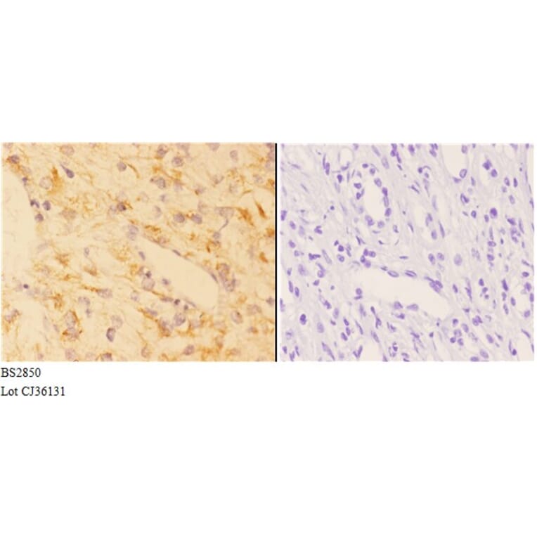 Anti-AChRα1 (E217) Antibody from Bioworld Technology (BS2850) - Antibodies.com