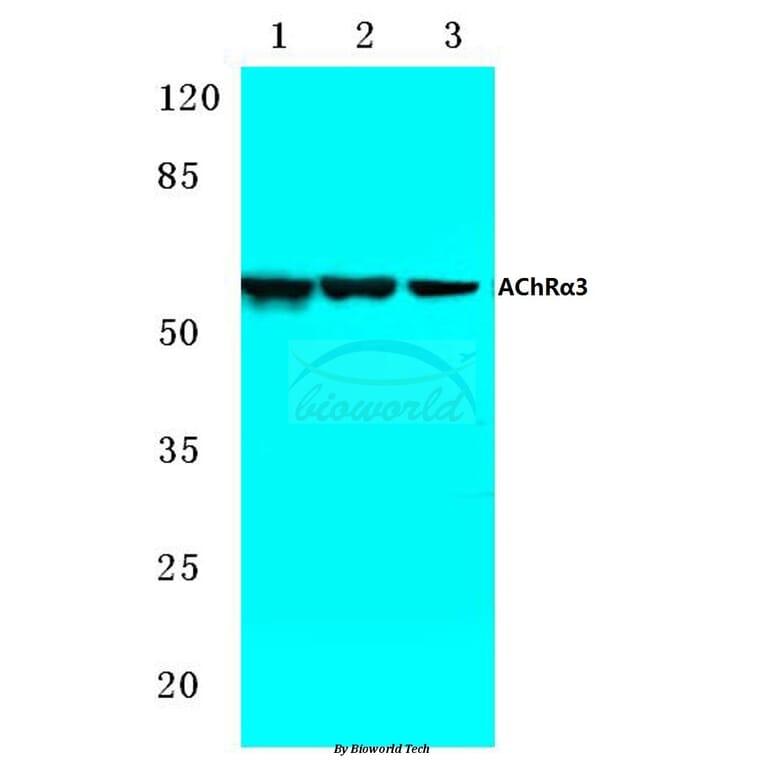 Anti-AChRα3 (L139) Antibody from Bioworld Technology (BS2851) - Antibodies.com
