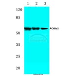 Anti-AChRα3 (L139) Antibody from Bioworld Technology (BS2851) - Antibodies.com
