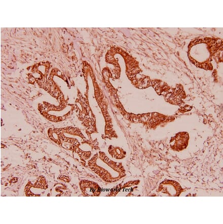 Anti-GDF-8 (L38) Antibody from Bioworld Technology (BS2852) - Antibodies.com