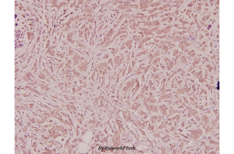 Anti-VEGF-A (R159) Antibody from Bioworld Technology (BS2853) - Antibodies.com