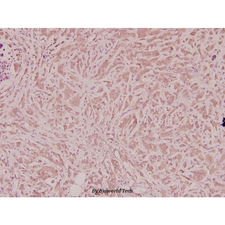 Anti-VEGF-A (R159) Antibody from Bioworld Technology (BS2853) - Antibodies.com