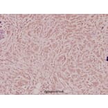 Anti-VEGF-A (R159) Antibody from Bioworld Technology (BS2853) - Antibodies.com