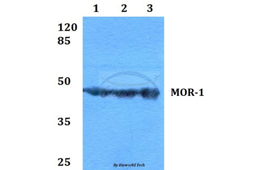 Anti-MOR-1 (S57) Antibody from Bioworld Technology (BS2862) - Antibodies.com