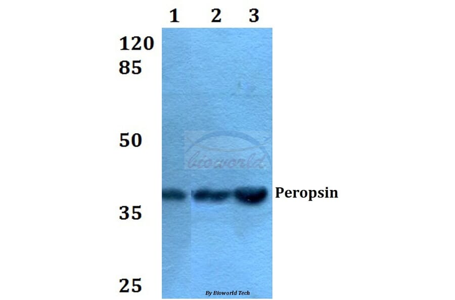 Anti-Peropsin (D237) Antibody from Bioworld Technology (BS2863) - Antibodies.com
