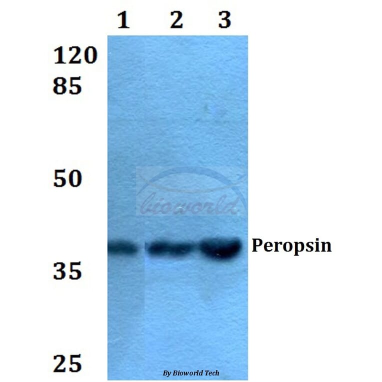 Anti-Peropsin (D237) Antibody from Bioworld Technology (BS2863) - Antibodies.com