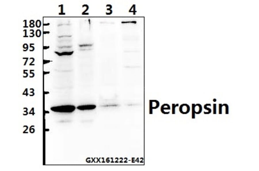 Anti-Peropsin (D237) Antibody from Bioworld Technology (BS2863) - Antibodies.com