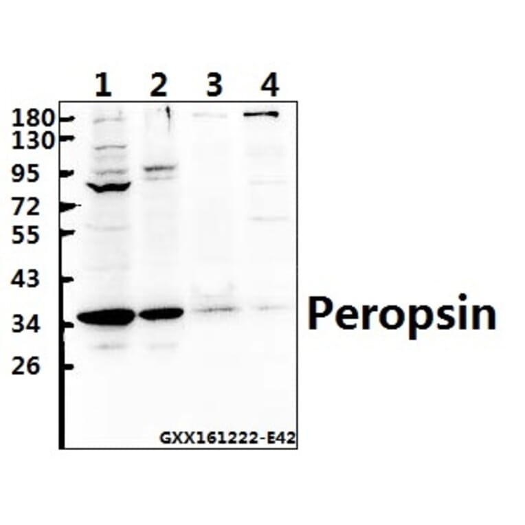 Anti-Peropsin (D237) Antibody from Bioworld Technology (BS2863) - Antibodies.com