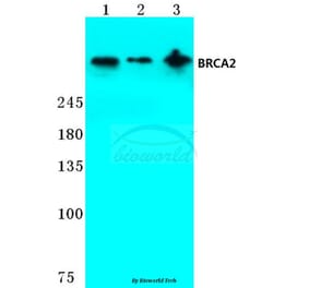 Anti-BRCA2 (N60) Antibody from Bioworld Technology (BS2864) - Antibodies.com