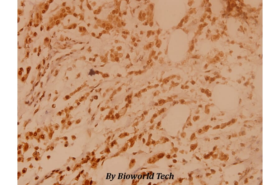 Anti-BRCA2 (N60) Antibody from Bioworld Technology (BS2864) - Antibodies.com