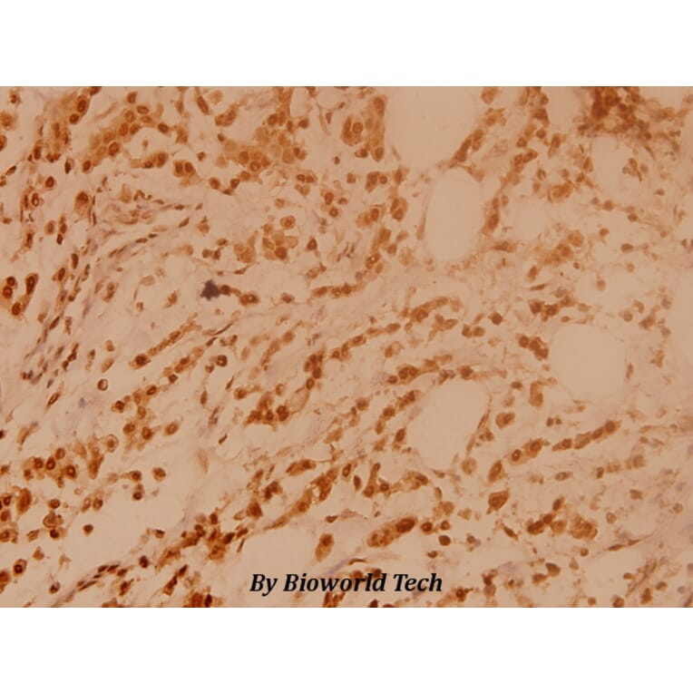 Anti-BRCA2 (N60) Antibody from Bioworld Technology (BS2864) - Antibodies.com