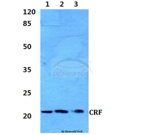 Anti-CRF (R153) Antibody from Bioworld Technology (BS2869) - Antibodies.com