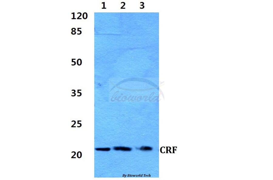 Anti-CRF (R153) Antibody from Bioworld Technology (BS2869) - Antibodies.com
