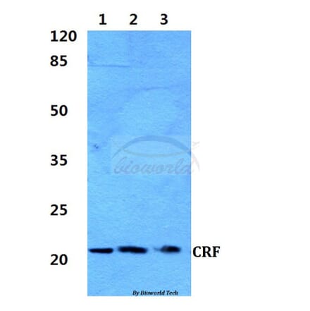 Anti-CRF (R153) Antibody from Bioworld Technology (BS2869) - Antibodies.com
