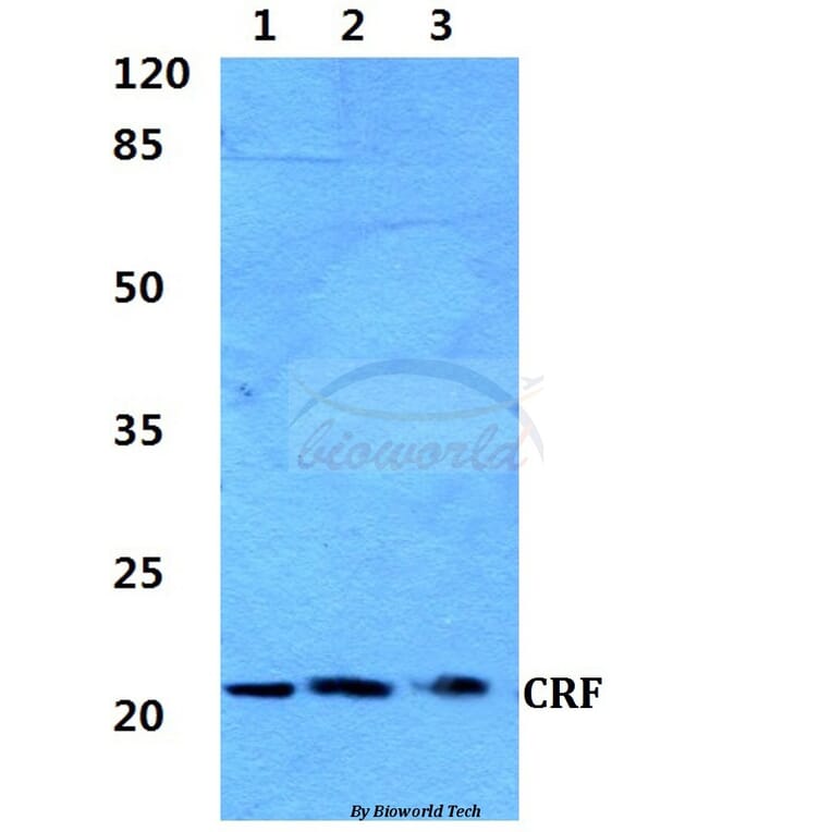 Anti-CRF (R153) Antibody from Bioworld Technology (BS2869) - Antibodies.com