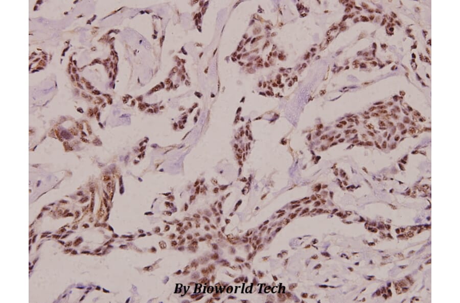 Anti-CRF (R153) Antibody from Bioworld Technology (BS2869) - Antibodies.com