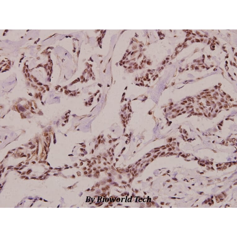 Anti-CRF (R153) Antibody from Bioworld Technology (BS2869) - Antibodies.com