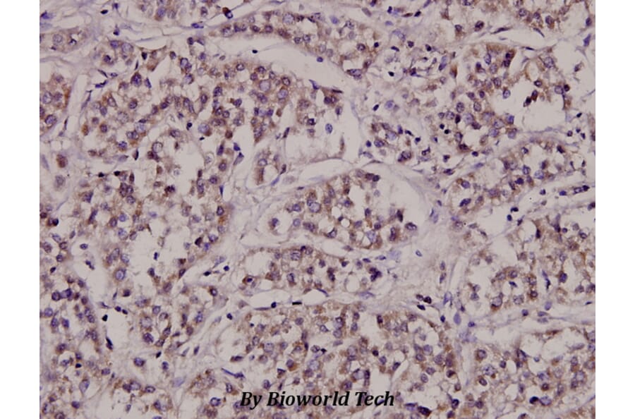 Anti-CTPS (K109) Antibody from Bioworld Technology (BS2871) - Antibodies.com