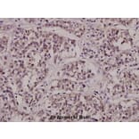 Anti-CTPS (K109) Antibody from Bioworld Technology (BS2871) - Antibodies.com