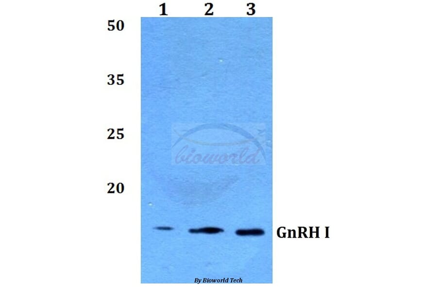 Anti-GnRH I (D43) Antibody from Bioworld Technology (BS2880) - Antibodies.com