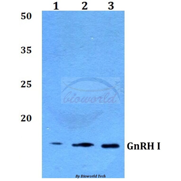 Anti-GnRH I (D43) Antibody from Bioworld Technology (BS2880) - Antibodies.com