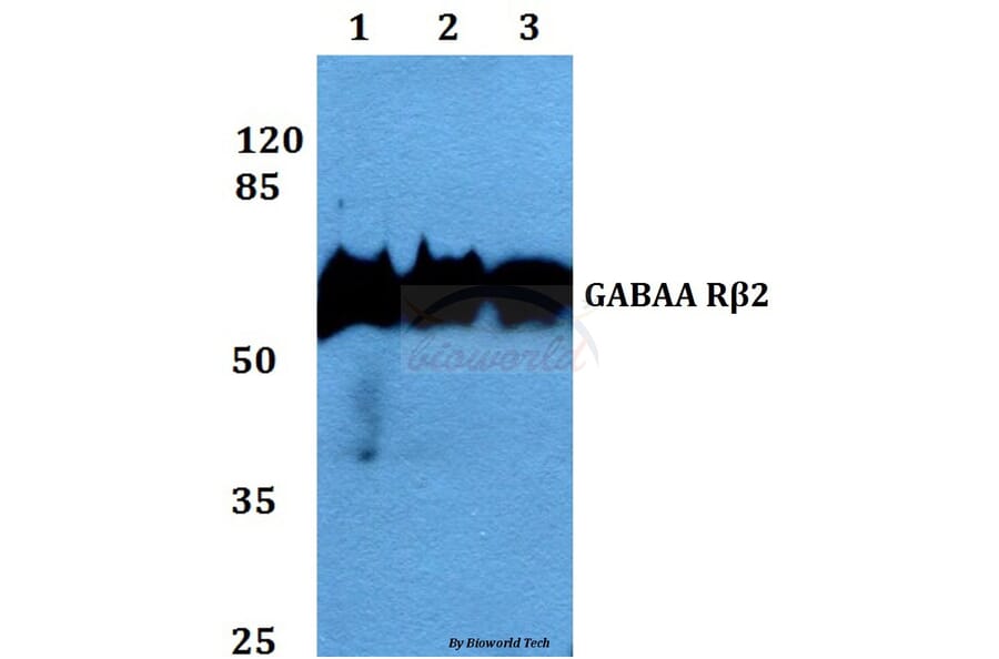 Anti-GABAA Rβ2 (R431) Antibody from Bioworld Technology (BS2907) - Antibodies.com