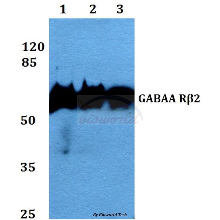 Anti-GABAA Rβ2 (R431) Antibody from Bioworld Technology (BS2907) - Antibodies.com