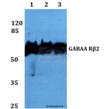 Anti-GABAA Rβ2 (R431) Antibody from Bioworld Technology (BS2907) - Antibodies.com