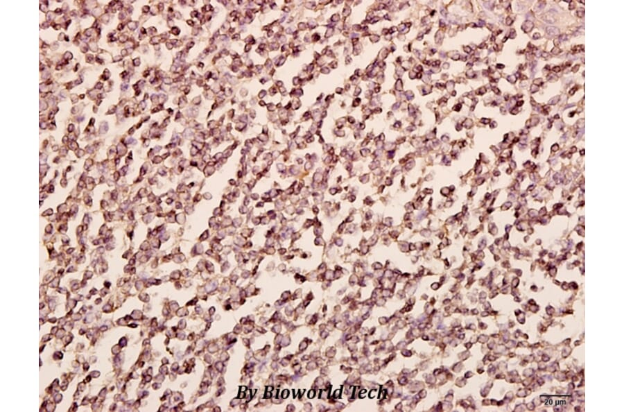 Anti-PFKP (E369) Antibody from Bioworld Technology (BS2911) - Antibodies.com