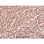 Anti-PFKP (E369) Antibody from Bioworld Technology (BS2911) - Antibodies.com